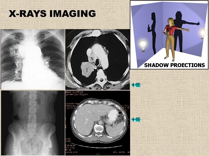 X-RAYS IMAGING SHADOW PROECTIONS